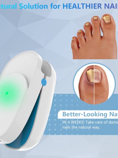 Infrared Laser For Nail Fungus Treatment